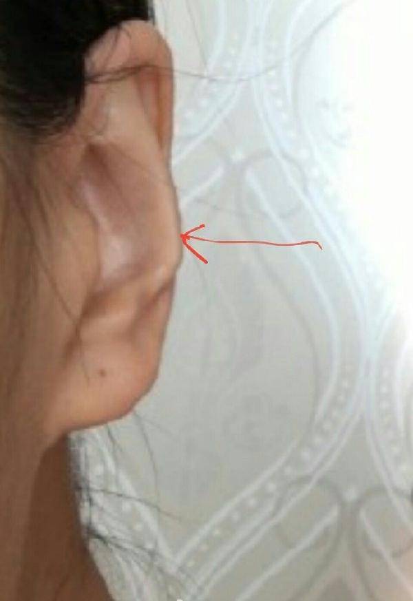 女人耳朵反骨贴脑图片